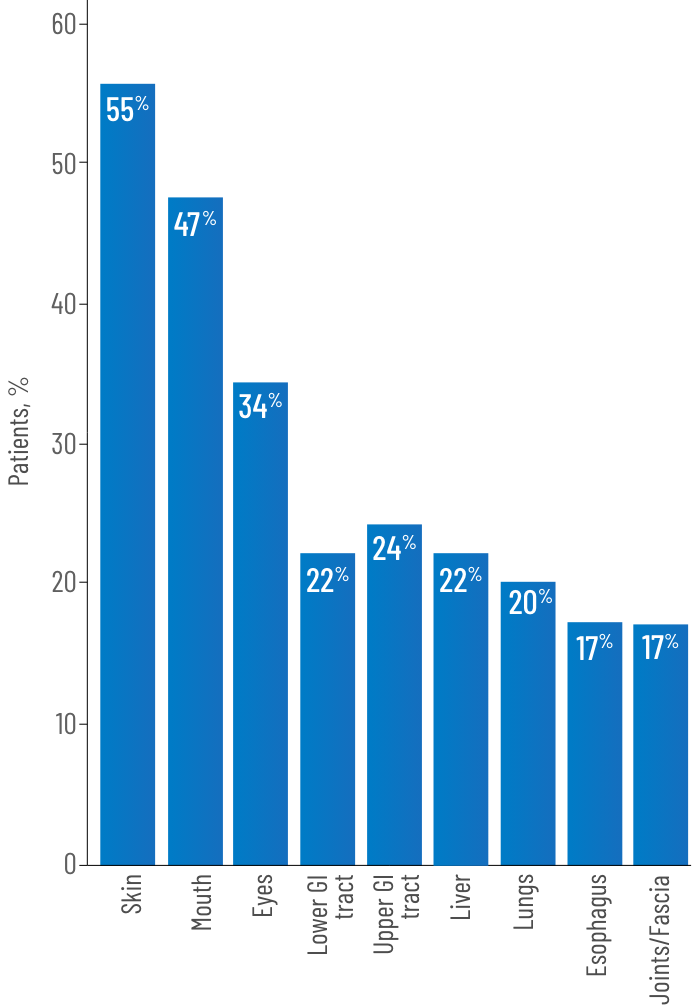 bar graph showing percentage of patients with cGVHD with organ involvement in the skin, mouth, eyes, lower GI tract, upper GI tract, liver, lungs, esophagus and joints/fascia