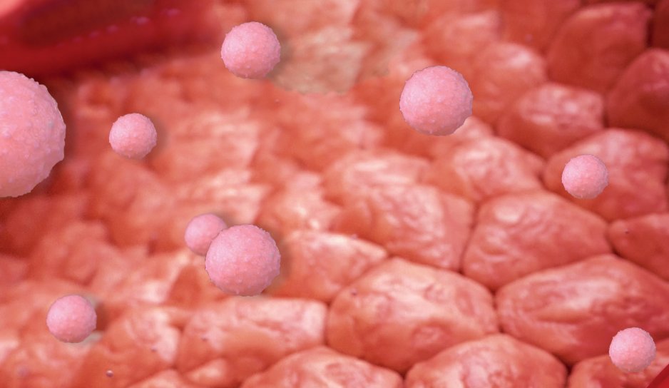 a depiction of inflamed tissue with few pink cells and an arrow pointing down indicating a few Treg cells